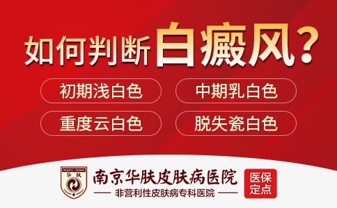 南京哪家白癜风医院比较有名