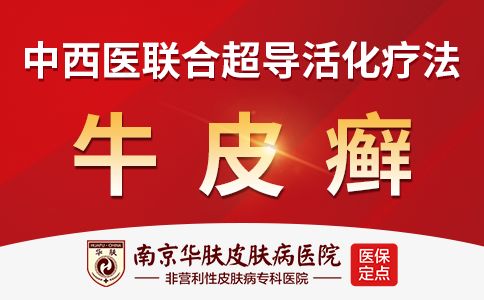 南京治疗牛皮癣的医院