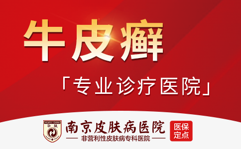 南京哪里的医院治疗牛皮癣比较有名