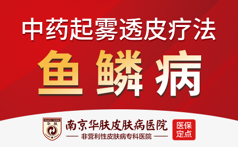 南京专治鱼鳞病医院