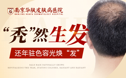 南京看斑秃哪里好
