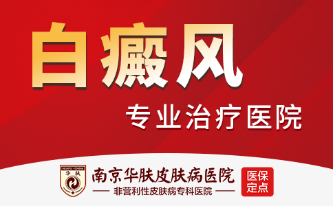 南京看白癜风的医院